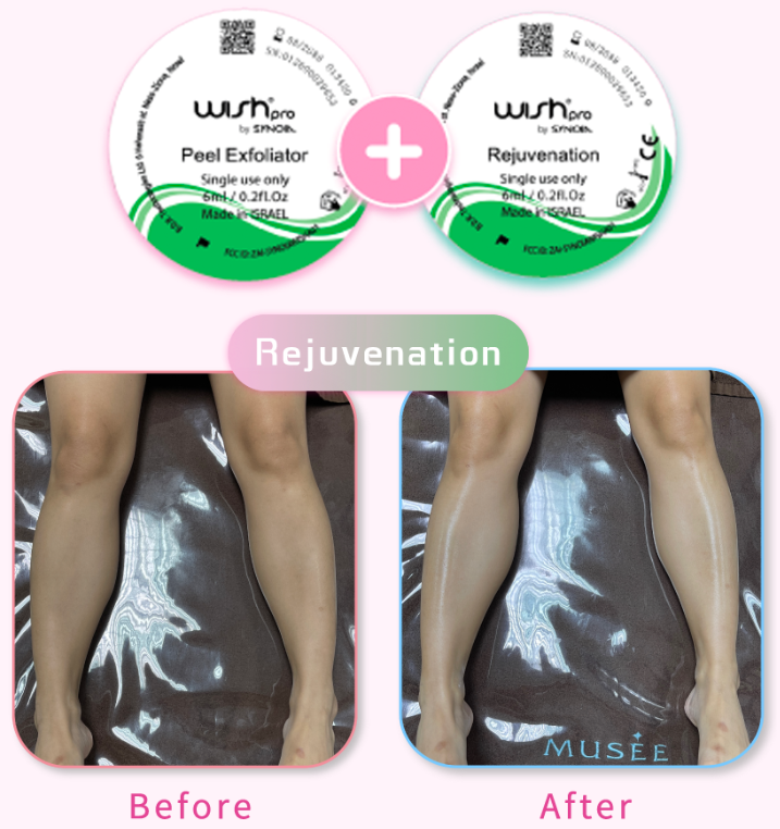 Wishpro Rejuvenation