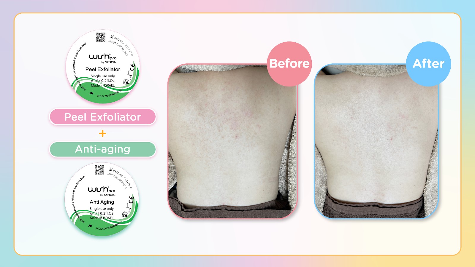 peel-exfoliator-and-anti-aging-before-after