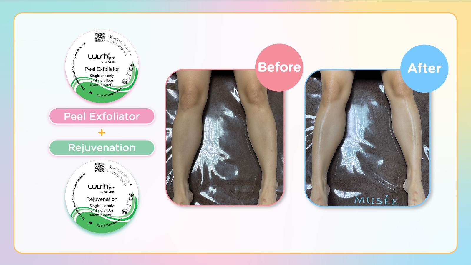 peel-exfoliator-and-rejuvenation-before-after