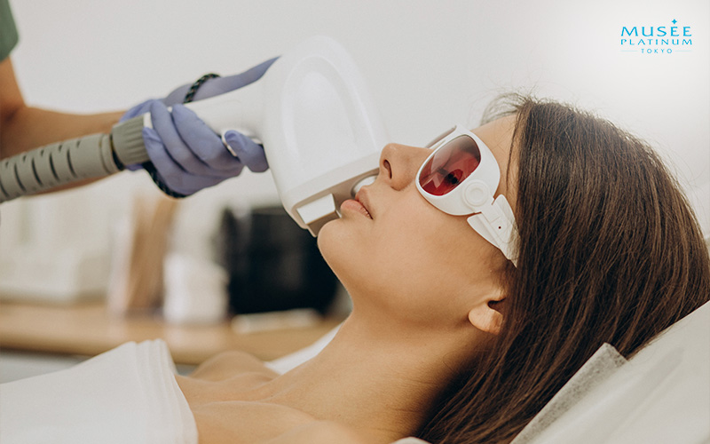 woman-getting-face-hair-removed-through-diode-laser-hair-removal