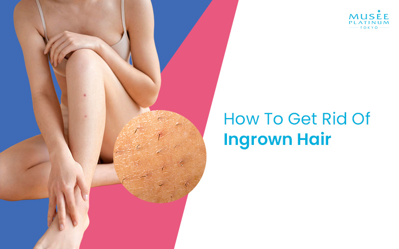 Woman Skin With Magnified Ingrown Hairs