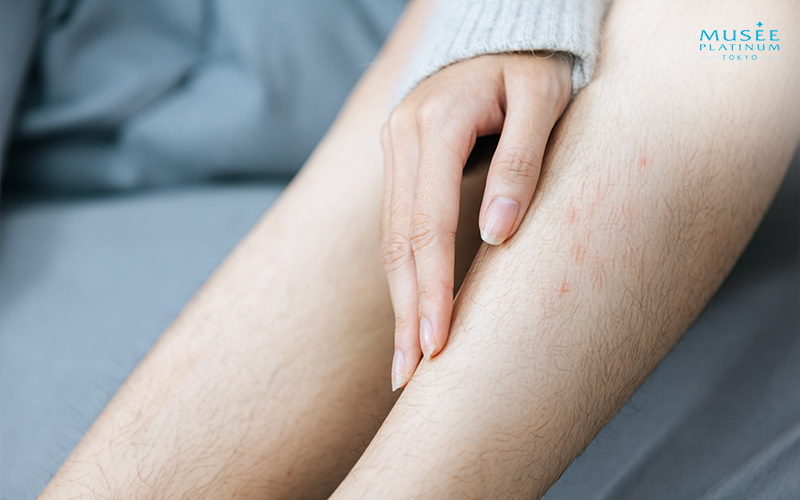 woman-with-leg-hair